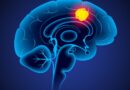 Common pain drug may add months to brain cancer survival, researchers find