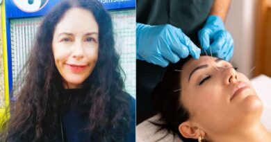 I tried acupuncture and had an unexpected experience – it was astonishing | UK | News I tried acupuncture and had an unexpected experience – it was astonishing | UK | News