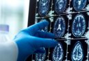 Men’s brains shrink faster than women’s brains, new study reveals