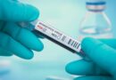Three cases of new mpox strain requiring hospitalization confirmed in California
