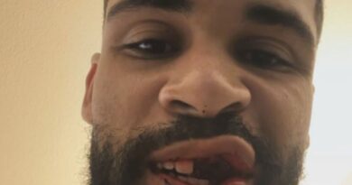 England’s Ruben Loftus-Cheek reveals gruesome injuries after horror clash | Football | Sport