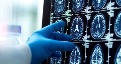 Common bacterium in the eye linked to Alzheimer’s, study finds