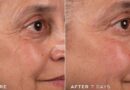 Medik8’s £27 anti-ageing cream ‘incredible’ for ‘smoothing out lines’