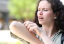 Mosquito bites stop itching fast with doctor’s free tip