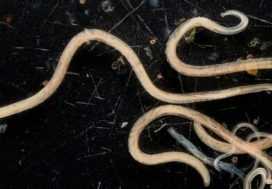 ‘Deadly tapeworm’ outbreak – humans and dogs accidental hosts | World | News ‘Deadly tapeworm’ outbreak – humans and dogs accidental hosts | World | News