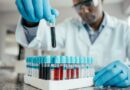 Blood test measuring biological age could predict dementia risk, study suggests