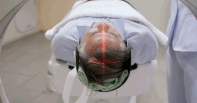 Longevity gene linked to centenarians may protect brain from Alzheimer’s