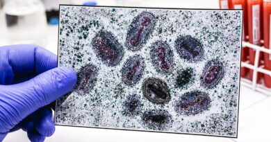 Connecticut confirms first clade I mpox case linked to travel in Europe