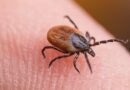 Tick bite ER visits hit highest seasonal level amid Lyme disease surge