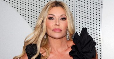 RHOBH star Brandi Glanville says doctors found benign tumor in her face