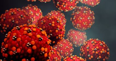 Measles exposure reported at LAX, nearby Hilton hotel after June flight