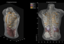 A behind-the-scenes look at Midjourney’s medical scanner leaves many questions unanswered