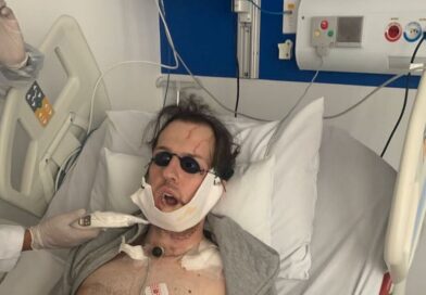 Man has his jaw rebuilt with leg bone after horror fall chasing thief | World | News