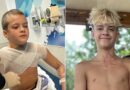 Viral NeeDoh microwave trend leaves teen with third-degree burns