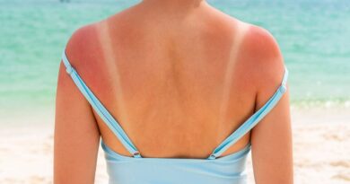 ‘Tanmaxxing’ trend, promoting more sun, raises concern among dermatologists