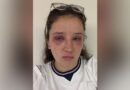 Bride gets severe allergic reaction to eyelash extensions before wedding