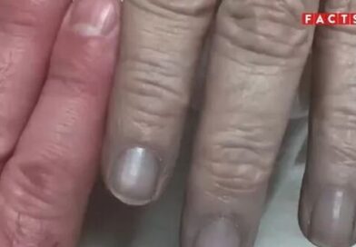 Decades of incest caused isolated family to be born with blue skin Decades of incest caused isolated family to be born with blue skin