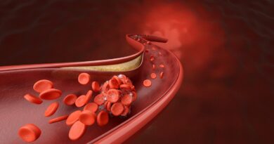 Early statins tied to 15% lower dementia risk in type 2 diabetes study
