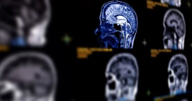 Menopause brain fog vs. dementia: How women can tell the difference