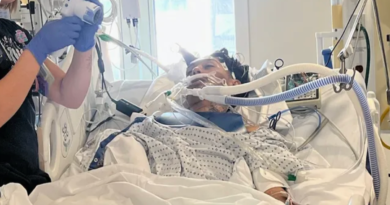 Brain-eating amoeba kills North Carolina teen in rare infection