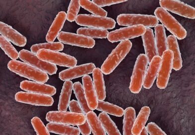 What is pneumonic plague? What to know after woman in Russia diesmysteriously